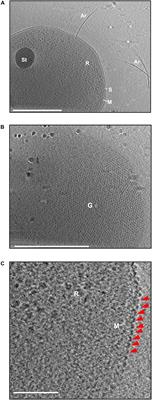 Analysis of Cell–Cell Bridges in Haloferax volcanii Using Electron Cryo-Tomography Reveal a Continuous Cytoplasm and S-Layer